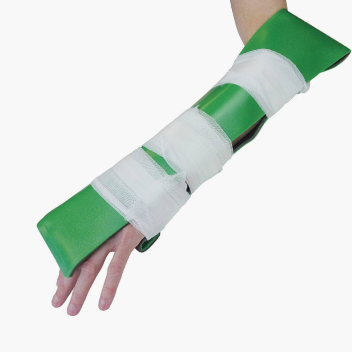 HypaGuard Flexible Emergency Splint - In Use